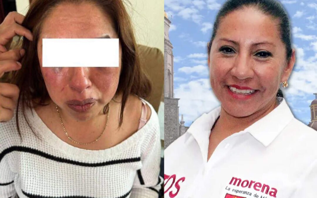 Alcaldesa de Morena es acusada de brutal agresión a empleada del DIF en Capulhuac
