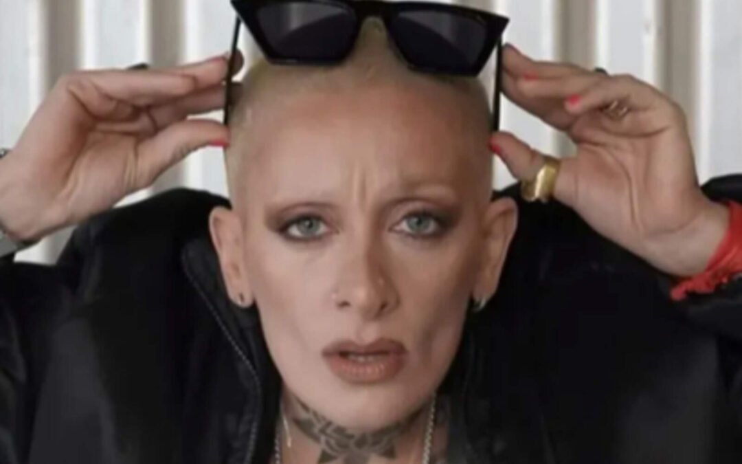 Juliana “Furia” Scaglione se hizo un retoque estético y mostró el increíble resultado