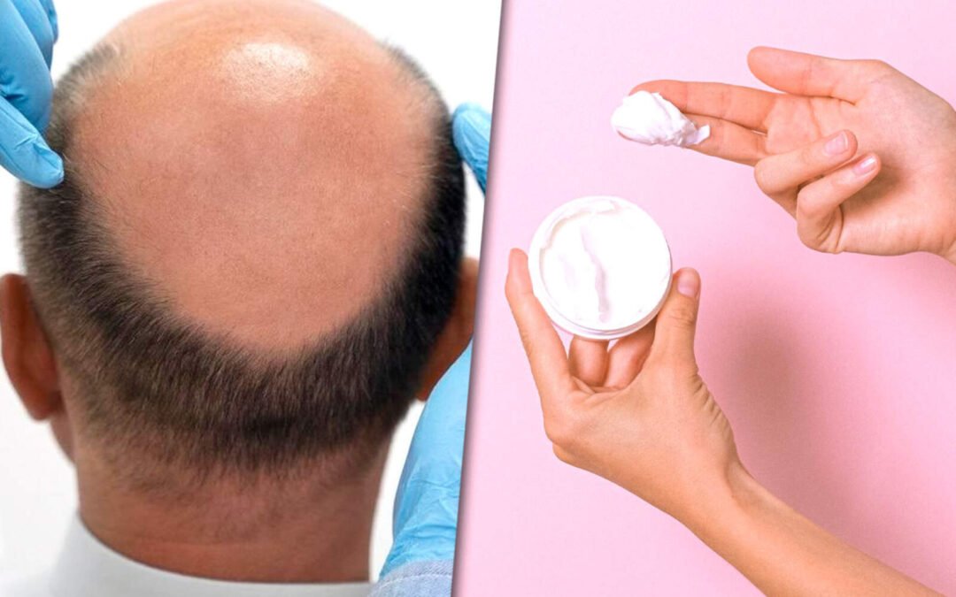 Hallan una molécula que despierta los folículos y ayuda a recuperar el pelo