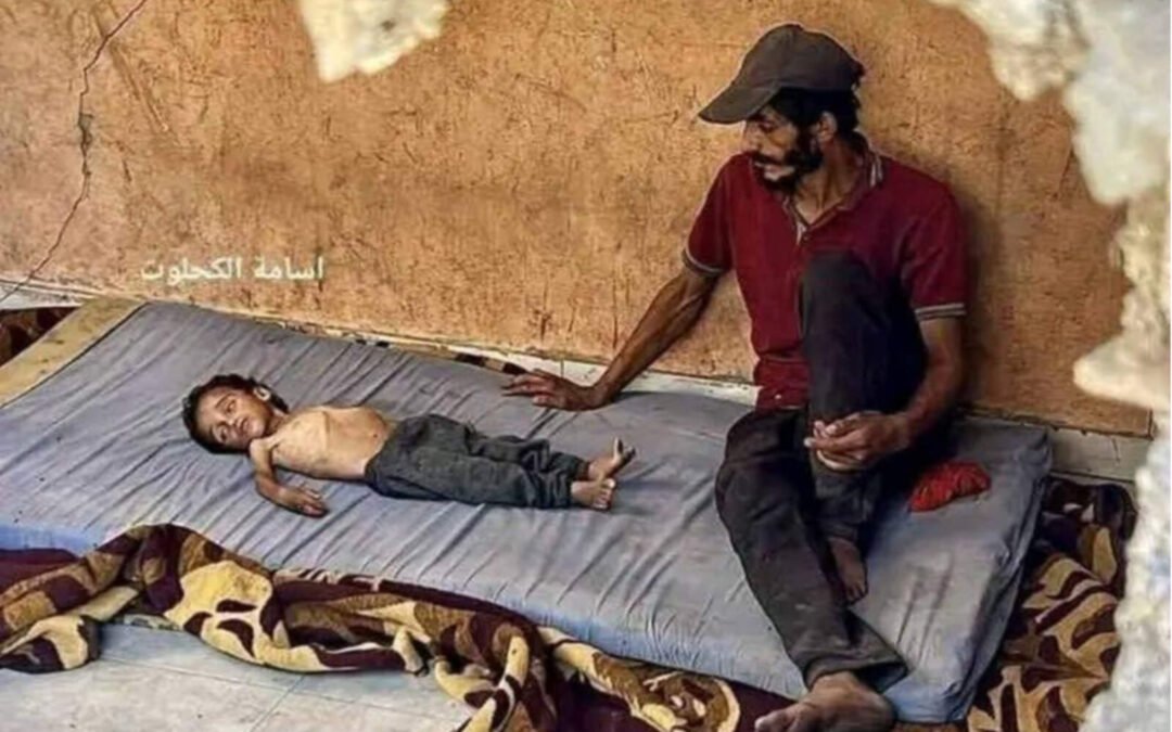 Otra falsa imagen de un niño en Gaza: incluso fue atendido en hospitales israelíes