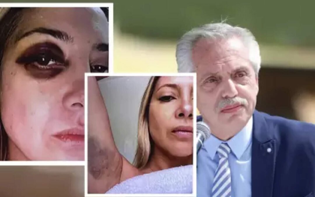 El golpeador Alberto Fernández podría enfrentar 12 años de prisión por violencia