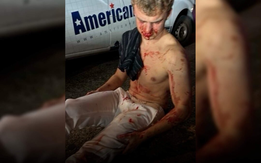 El ex empleado del DOGE ‘Big Balls’ fue atacado brutalmente por pandilleros