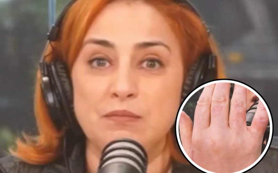 María Julia Oliván reapareció tras 17 cirugías: ‘Regresé de la muerte’