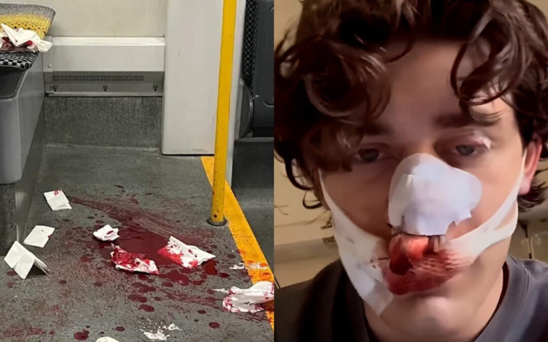 Dos sirios apuñalan a un joven de EE.UU. tras frenar una agresión sexual a una alemana