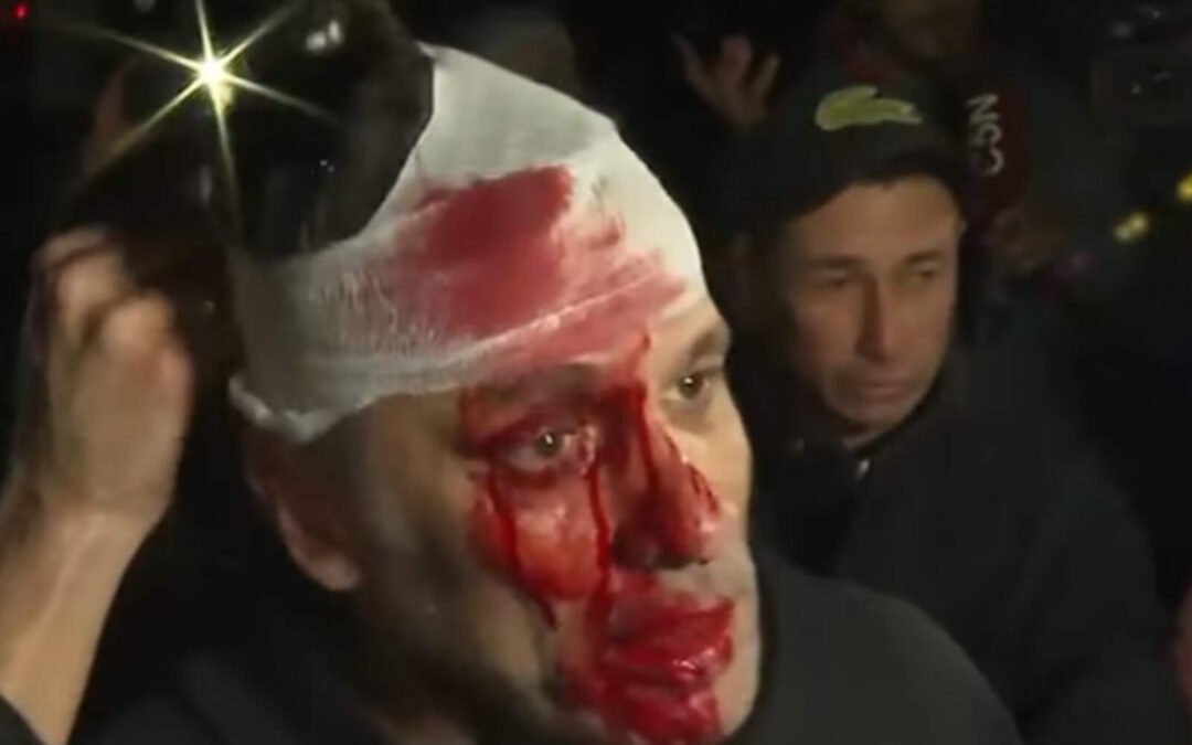 Nefasto: militantes kirchneristas partieron la cabeza de un periodista con una botella